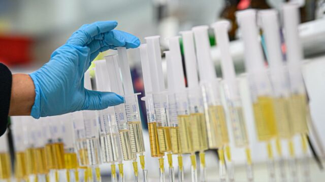 Ministério do Esporte propõe emendas para punir sindicatos de doping organizados com até 10 anos de prisão
