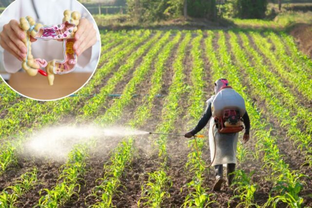 O aumento do câncer colorretal em adultos jovens pode estar ligado ao herbicida comum
