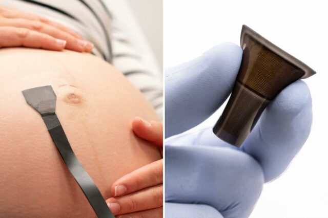 Patch de ultrassom vestível pode monitorar gestações de alto risco Uma mulher grávida usando um adesivo de monitoramento na barriga.