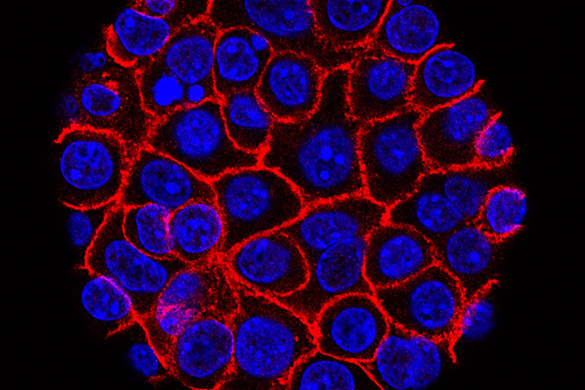 Pílula experimental promete nova esperança para câncer pancreático mortal