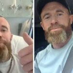 O tradie irlandês Noel Quinn foi diagnosticado com melanoma no mês passado.