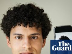 ‘Você não pode controlar tudo’: o aumento de cirurgiões plásticos solicitados a criar ‘rosto de IA’ ‘Você não pode controlar tudo’: o aumento de cirurgiões plásticos solicitados a criar ‘rosto de IA’