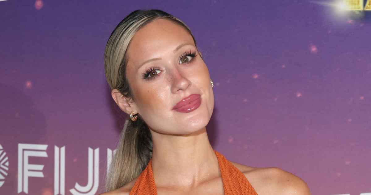 Bachelorette Alum Rachel Recchia revela cicatrizes de redução de mama anos depois