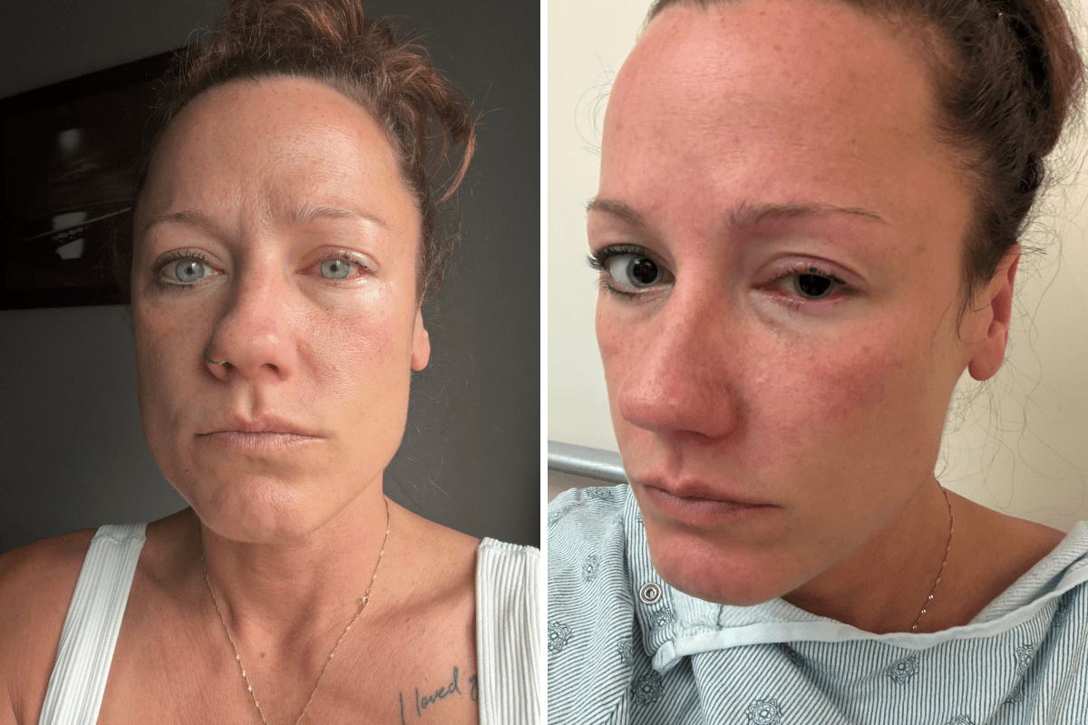 Leigh Stanger, 43, opening her eye in hospital.