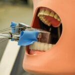 Conheça o robô dental para perfuração dentária