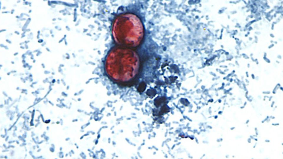 Parasita causador de diarreia que pode contaminar produtos crus, causando miséria em vários estados